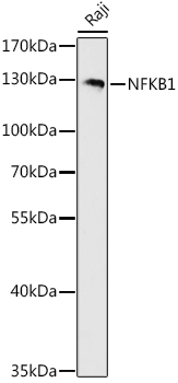 NFKB1 Rabbit Polyclonal Antibody