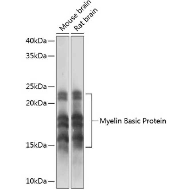 Myelin Basic Protein Rabbit Monoclonal Antibody