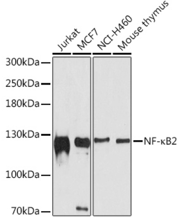 NF-?B2 Rabbit Polyclonal Antibody