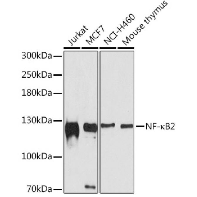 NF-?B2 Rabbit Polyclonal Antibody