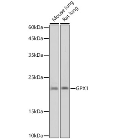 GPX1 Rabbit Monoclonal Antibody
