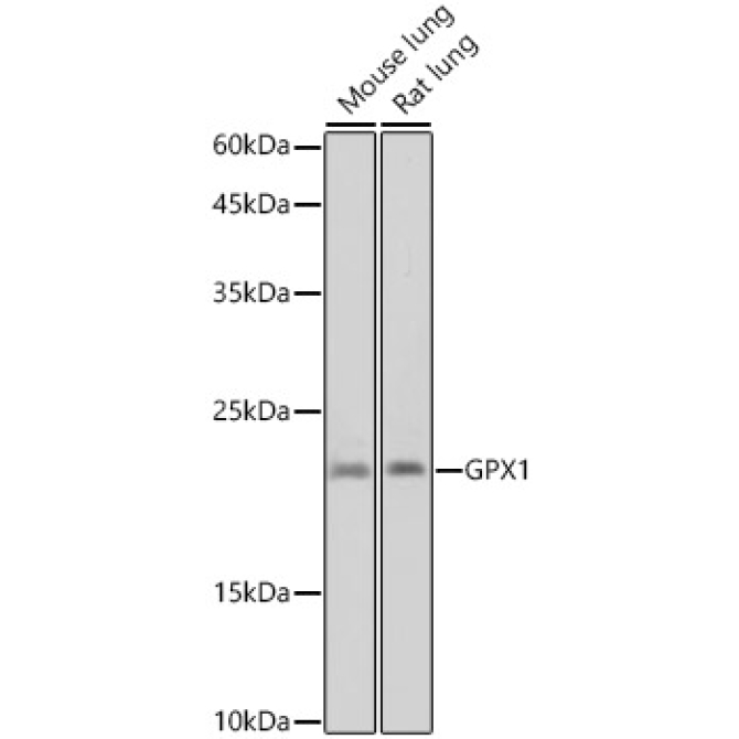 GPX1 Rabbit Monoclonal Antibody