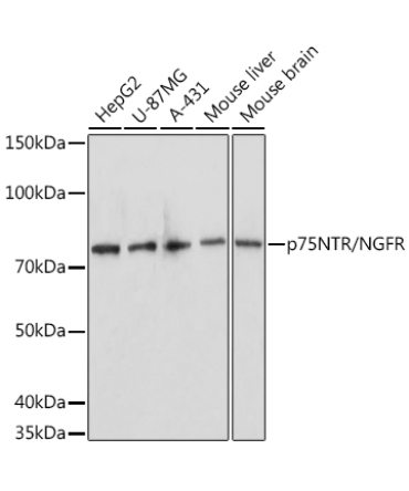 p75NTR/NGFR Rabbit Polyclonal Antibody