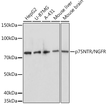 p75NTR/NGFR Rabbit Polyclonal Antibody