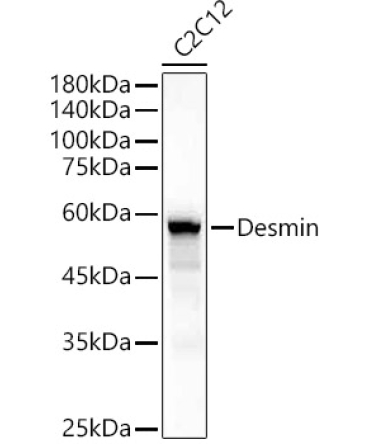 Desmin Rabbit Polyclonal Antibody