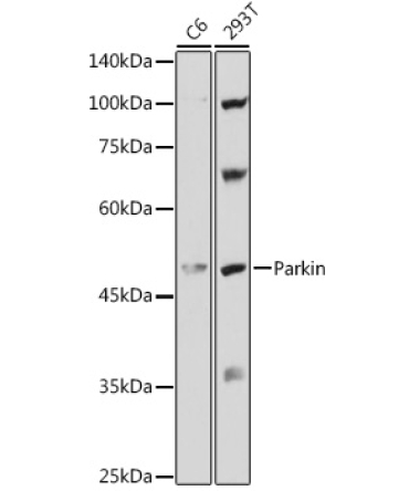 Human Parkin Rabbit Polyclonal Antibody