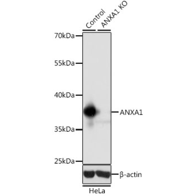 ANXA1 Rabbit Polyclonal Antibody [KO Validated]