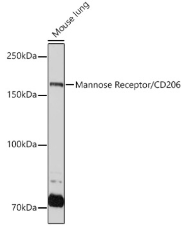 Mannose Receptor/CD206 Rabbit Monoclonal Antibody