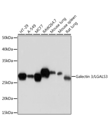 Galectin 3/LGALS3 Rabbit Monoclonal Antibody