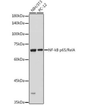 NF-kB p65/RelA Rabbit Polyclonal Antibody