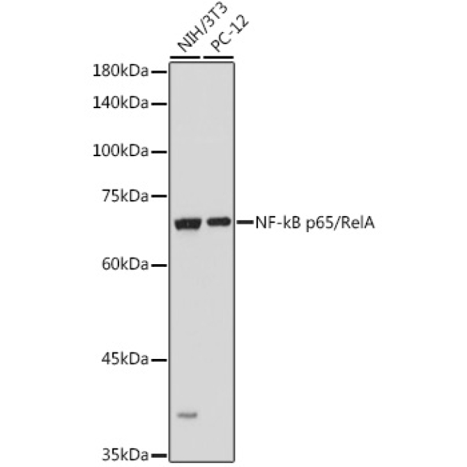 NF-kB p65/RelA Rabbit Polyclonal Antibody