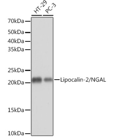 Lipocalin-2/NGAL Rabbit Monoclonal Antibody