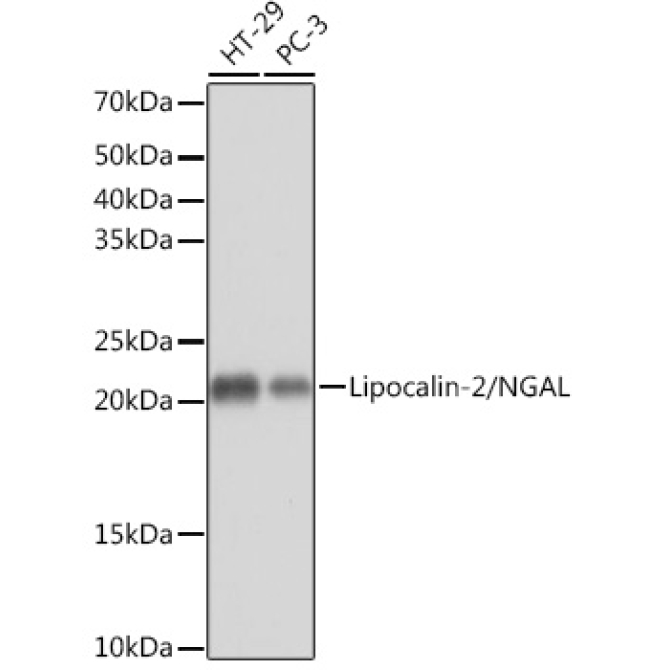 Lipocalin-2/NGAL Rabbit Monoclonal Antibody