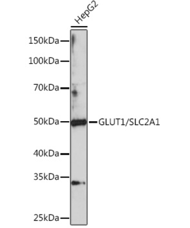 GLUT1/SLC2A1 Rabbit Polyclonal Antibody