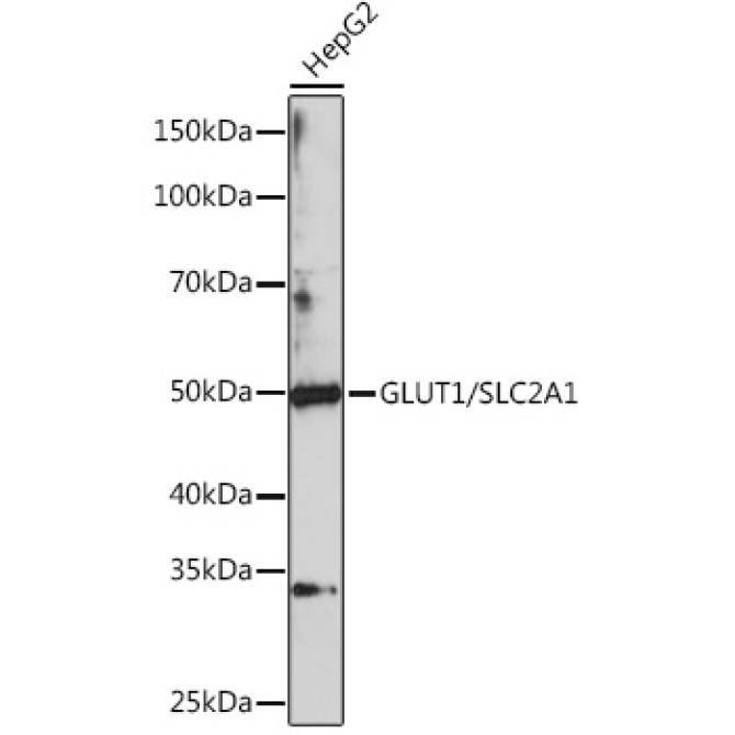 GLUT1/SLC2A1 Rabbit Polyclonal Antibody