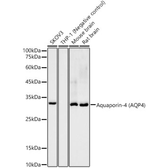 Aquaporin-4 (AQP4) Rabbit Monoclonal Antibody