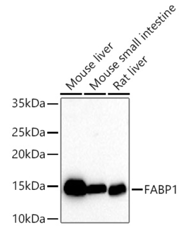 FABP1 Rabbit Monoclonal Antibody