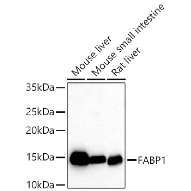 FABP1 Rabbit Monoclonal Antibody