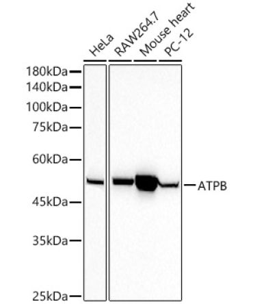 ATPB Rabbit Monoclonal Antibody
