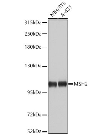 MSH2 Rabbit Polyclonal Antibody