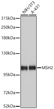 MSH2 Rabbit Polyclonal Antibody