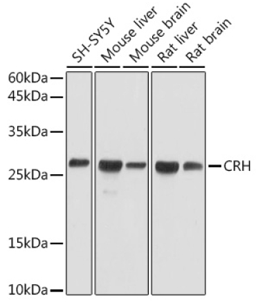 CRH Rabbit Polyclonal Antibody