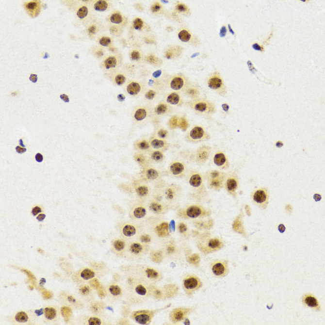 p53 Rabbit Polyclonal Antibody