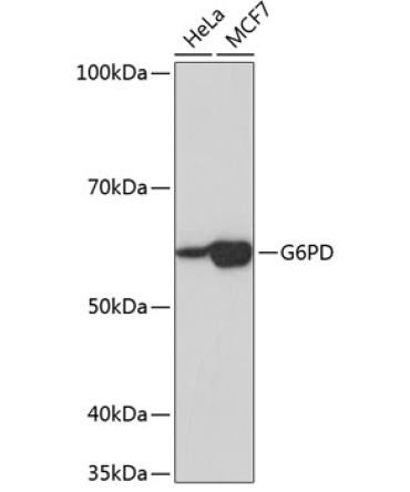 G6PD Rabbit Monoclonal Antibody