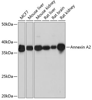 Annexin A2 Rabbit Monoclonal Antibody