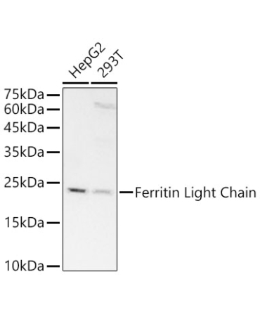 Ferritin Light Chain Rabbit Monoclonal Antibody