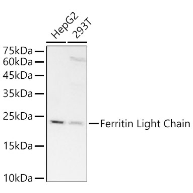 Ferritin Light Chain Rabbit Monoclonal Antibody