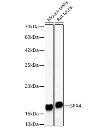 GPX4 Rabbit Monoclonal Antibody [KD Validated]