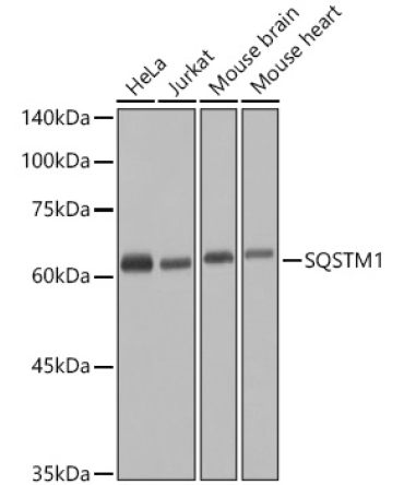 SQSTM1/p62 Rabbit Polyclonal Antibody [KO Validated]