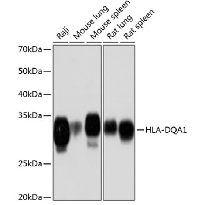 HLA-DQA1 Rabbit Monoclonal Antibody