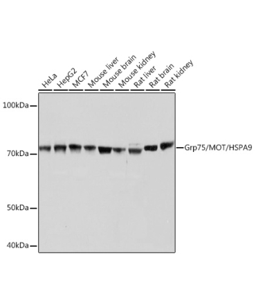 Grp75/MOT/HSPA9 Rabbit Monoclonal Antibody