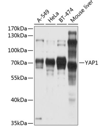 YAP1 Rabbit Polyclonal Antibody [KO Validated]