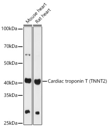 Cardiac troponin T (TNNT2) Rabbit Polyclonal Antibody