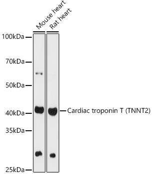 Cardiac troponin T (TNNT2) Rabbit Polyclonal Antibody