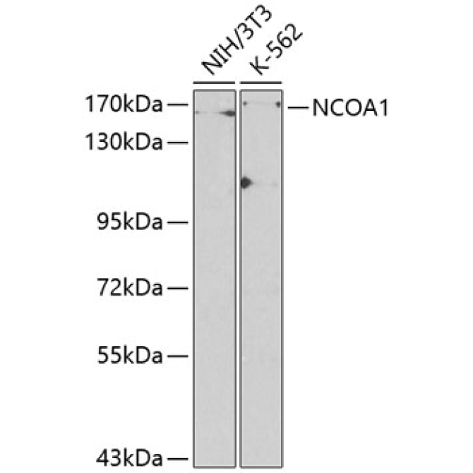 NCOA1 Rabbit Polyclonal Antibody