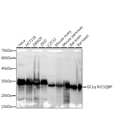 GC1q R/C1QBP Rabbit Monoclonal Antibody