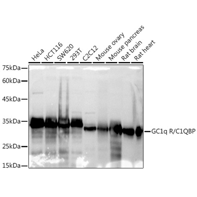 GC1q R/C1QBP Rabbit Monoclonal Antibody