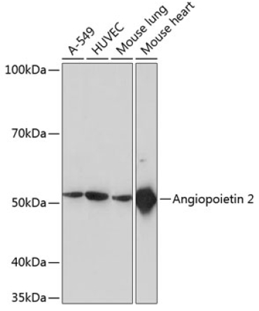 ANGPT2 Rabbit Monoclonal Antibody