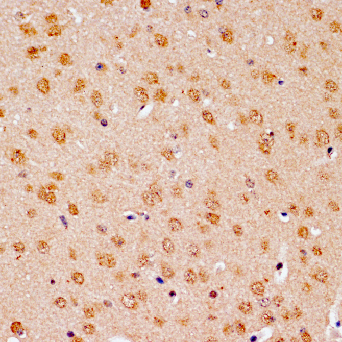 Bcl-2 Rabbit Polyclonal Antibody