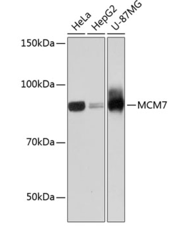 MCM7 Rabbit Monoclonal Antibody