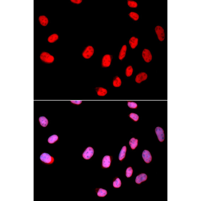 CDC25C Rabbit Polyclonal Antibody
