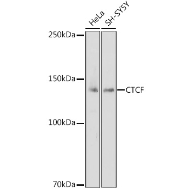 CTCF Rabbit Polyclonal Antibody