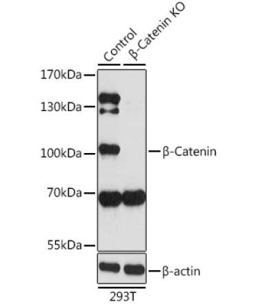 Beta-Catenin Rabbit Polyclonal Antibody [KO Validated]