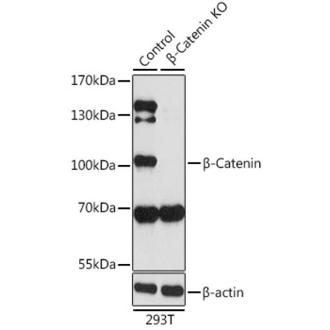 Beta-Catenin Rabbit Polyclonal Antibody [KO Validated]