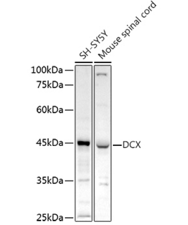 Doublecortin Rabbit Polyclonal Antibody