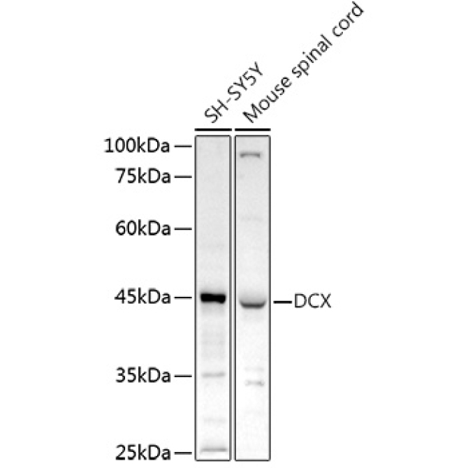 Doublecortin Rabbit Polyclonal Antibody
